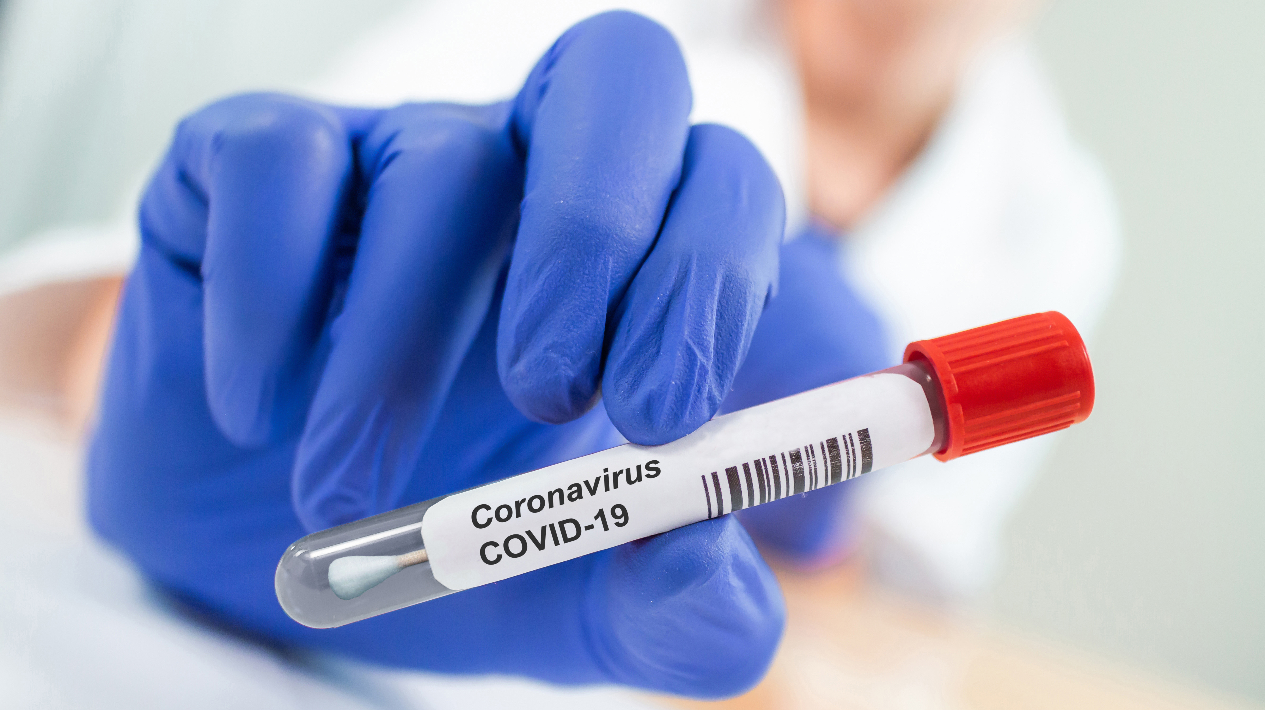 CU Medicine Offers Free Stool Screening Test for COVID-19 in Children arriving at Airport